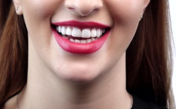 چگونه دندان های زیبا داشته باشیم